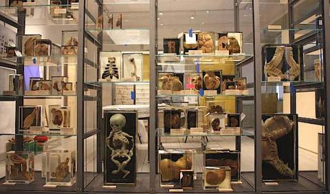 Fra den nyåbnede udstilling. Foto: Medicinsk Museion