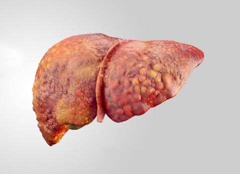 En af forskerne på FLASH, som studerer tarmbakteriernes verden, er læge Johanne Kragh Hansen. Hun undersøger, om det er muligt at »fodre« tarmfloraen, så den dæmper dannelsen af arvæv i leveren hos mennesker med alkoholrelateret skrumpelever. Illustration: BigstockPhoto