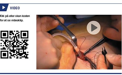 <a href="https://player.vimeo.com/video/156546599">Se video her</a></P>