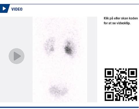 <A href="https://player.vimeo.com/video/138295945">Link til video</A></P>