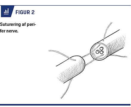 Illustration: Alexander Alamri.