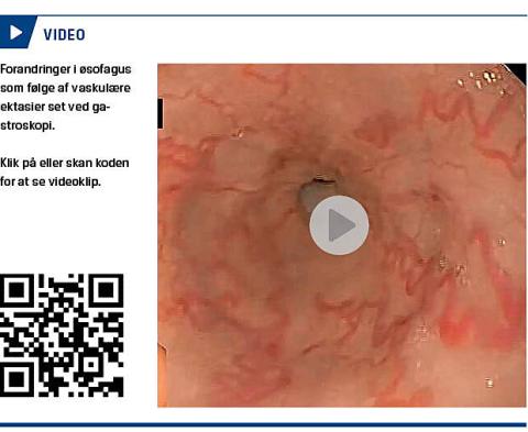 <A href="https://drive.google.com/file/d/0ByI27UMb9NI8ZXk4RzZfMHlUSXM/view">Link til video</A></P>