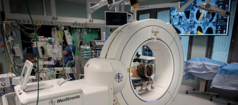 Laserinduceret termoterapi af en patient med hjernetumor på Karolinska Universitetssjukhuset i Stockholm.