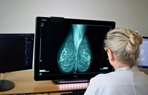 Screeningsbilleder dobbeltgranskes uafhængigt af to specialiserede brystradiologer.