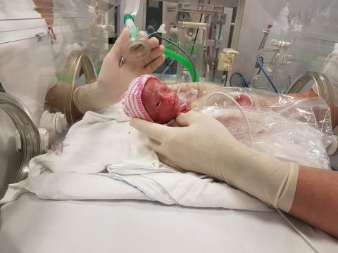 Barn, der er født i gestationsuge 27, ses her få timer efter fødslen. Barnet er i dag fire år og har ingen men af at være født ekstremt prætermt. (Billedet bringes med tilladelse fra forældrene).
