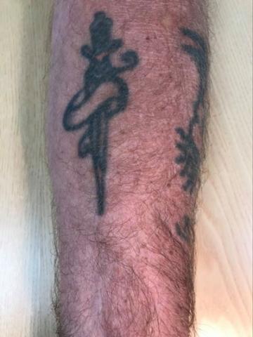 Bringes med tilladelse fra patienten.