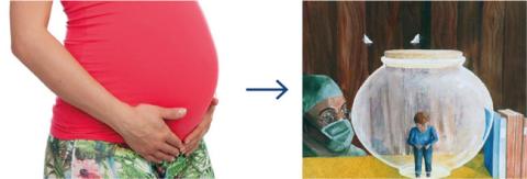 Gestationel diabetes mellitus øger risikoen for autisme­spektrumforstyrrelser hos barnet.